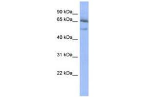 Image no. 1 for anti-Nuclear Factor of kappa Light Polypeptide Gene Enhancer in B-Cells Inhibitor, epsilon (NFKBIE) (AA 431-480) antibody (ABIN6742773)
