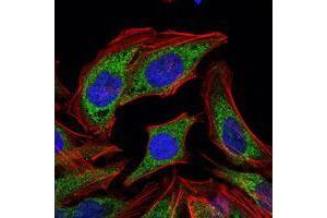 Immunofluorescence analysis of HELA cells using PDK1 mouse mAb (green). (PDPK1 anticorps)