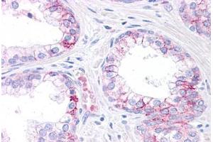 Human Prostate: Formalin-Fixed, Paraffin-Embedded (FFPE)