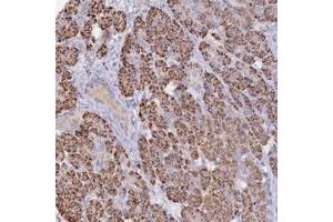 Immunohistochemical staining of human pancreas with WDR17 polyclonal antibody  shows strong granular cytoplasmic positivity in pancreatic acini.