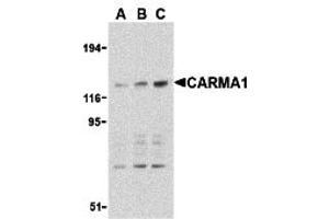 Western Blotting (WB) image for anti-Caspase Recruitment Domain Family, Member 11 (CARD11) (C-Term) antibody (ABIN1030313) (CARD11 anticorps  (C-Term))