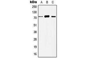 Western blot analysis of Histone Deacetylase 10 expression in HeLa (A), Jurkat (B), mouse liver (C), rat liver (D) whole cell lysates.
