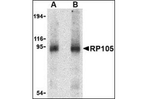 Western blot analysis of RP105 in human spleen tissue lysate with this product at (A) 0. (CD180 anticorps  (Center))