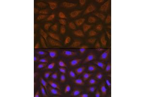 Immunofluorescence analysis of U-2 OS cells using eEF2 Rabbit mAb (ABIN7267025) at dilution of 1:100 (40x lens).