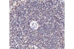 Immunohistochemistry analysis of paraffin-embedded rat spleen using,PQBP1 (ABIN7075126) at dilution of 1: 6000