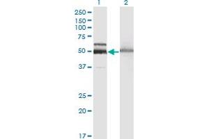 Western Blot analysis of HEXA expression in transfected 293T cell line by HEXA monoclonal antibody (M06A), clone 3D1. (Hexosaminidase A anticorps  (AA 1-529))