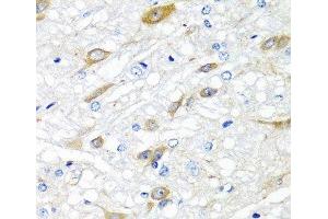 Immunohistochemistry of paraffin-embedded Rat brain using CPA6 Polyclonal Antibody at dilution of 1:100 (40x lens).