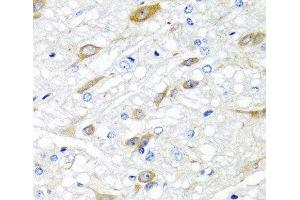 Immunohistochemistry of paraffin-embedded Rat brain using CPA6 Polyclonal Antibody at dilution of 1:100 (40x lens). (CPA6 anticorps)
