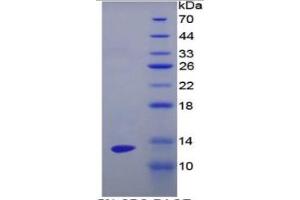 SDS-PAGE of Protein Standard from the Kit (Highly purified E. (ENO1 Kit ELISA)