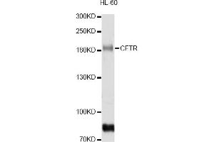 Western blot analysis of extracts of HL-60 cells, using CFTR antibody (ABIN5974674) at 1/1000 dilution. (CFTR anticorps)