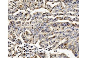 IHC analysis of CCNB1 using anti-CCNB1 antibody (ABIN7599335). (Cyclin B1 anticorps  (AA 1-383))
