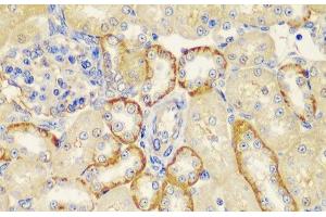 Immunohistochemistry of paraffin-embedded Rat kidney using MT1-MMP Polyclonal Antibody at dilution of 1:100 (40x lens). (MMP14 anticorps)