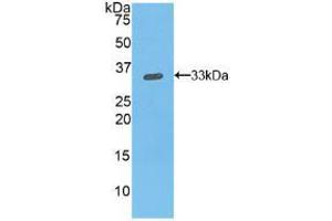 Western blot analysis of recombinant Mouse ITGb1. (ITGB1 anticorps  (AA 454-714))