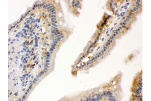 Immunohistochemistry (Paraffin-embedded Sections) (IHC (p)) image for anti-Heat Shock 70kDa Protein 1A (HSPA1A) (AA 559-596), (C-Term) antibody (ABIN3043849)