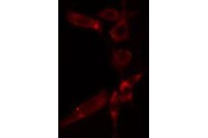 ABIN6277280 staining  HuvEc cells by IF/ICC. (AIF anticorps  (C-Term))