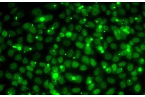 Immunofluorescence analysis of MCF7 cells using RPA3 Polyclonal Antibody (RPA3 anticorps)
