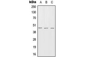 Western blot analysis of Serpin B7 expression in HEK293T (A), SP2/0 (B), rat brain (C) whole cell lysates. (SERPINB7 anticorps  (Center))
