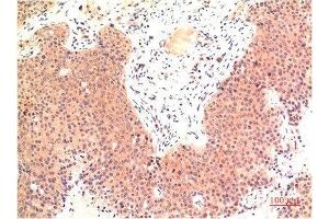 Immunohistochemical analysis of paraffin-embedded Human Colon Carcinoma Tissue using Epsilon Tubulin Mouse mAb diluted at 1:200.