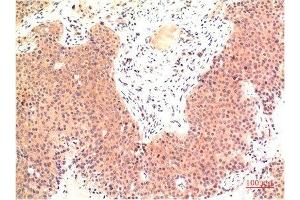 Immunohistochemical analysis of paraffin-embedded Human Colon Carcinoma Tissue using Epsilon Tubulin Mouse mAb diluted at 1:200. (TUBE1 anticorps)