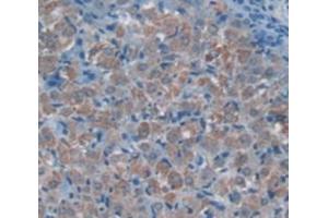 Figure. (alpha 2 Macroglobulin anticorps  (AA 574-734))