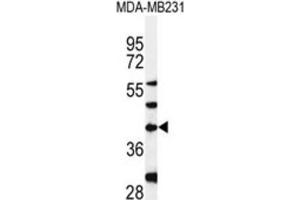 Western Blotting (WB) image for anti-Dolichyl-Phosphate (UDP-N-Acetylglucosamine) N-acetylglucosaminephosphotransferase 1 (GlcNAc-1-P Transferase) (DPAGT1) antibody (ABIN3004399) (DPAGT1 anticorps)