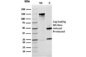 SDS-PAGE Analysis Purified LMO2 Mouse Monoclonal Antibody (rLMO2/1971). (Recombinant LMO2 anticorps  (AA 23-140))