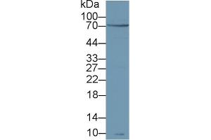Detection of zAP70 in Human Jurkat cell lysate using Polyclonal Antibody to Zeta Chain Associated Protein Kinase 70 kDa (zAP70) (ZAP70 anticorps  (AA 337-600))