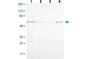 Western blot analysis of Lane 1: Human cell line RT-4 Lane 2: Human cell line U-251MG sp Lane 3: Human plasma (IgG/HSA depleted) Lane 4: Human liver tissue with ZNF550 polyclonal antibody . (ZNF550 anticorps)