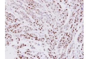 IHC-P Image Immunohistochemical analysis of paraffin-embedded MDAMB-468 xenograft, using CIP29, antibody at 1:100 dilution.