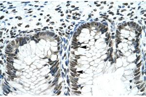 Rabbit Anti-GLI2 Antibody  Paraffin Embedded Tissue: Human Intestine Cellular Data: Epithelial cells of intestinal gland Antibody Concentration: 4.