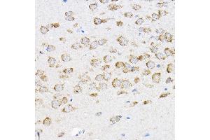 Immunohistochemistry of paraffin-embedded mouse brain using RPL4 Rabbit pAb (ABIN6129106, ABIN6147145, ABIN6147146 and ABIN6221591) at dilution of 1:100 (40x lens). (RPL4 anticorps  (AA 1-240))