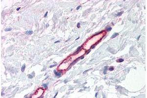 Human Breast, Vessels (formalin-fixed, paraffin-embedded) stained with PLXDC1 antibody ABIN337391 at 2. (PLXDC1 anticorps  (AA 411-427))