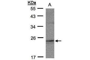 WB Image Sample(30 ug whole cell lysate) A:MOLT4 , 12% SDS PAGE antibody diluted at 1:500 (RAP2C anticorps)