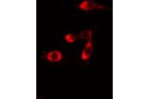 ABIN6275708 staining  Hela cells by IF/ICC. (RAD51C anticorps  (Internal Region))