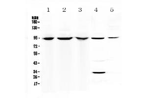Western blot analysis of Complement C7 using anti-Complement C7 antibody . (C7 anticorps  (AA 233-453))