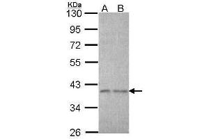 WB Image Sample (30 ug of whole cell lysate) A: A431 , B: H1299 10% SDS PAGE antibody diluted at 1:1000