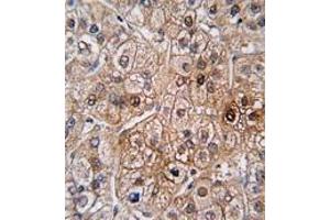 Image no. 2 for anti-Bone Morphogenetic Protein Receptor, Type II (serine/threonine Kinase) (BMPR2) (N-Term) antibody (ABIN357381)