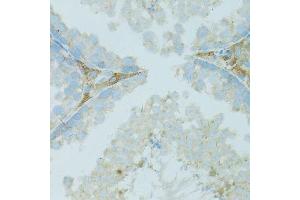 Immunohistochemistry of paraffin-embedded mouse testis using TJP2 antibody.