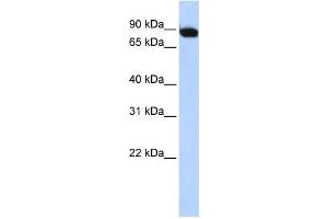 WB Suggested Anti-CREBL1 Antibody Titration: 0. (ATF6B anticorps  (Middle Region))