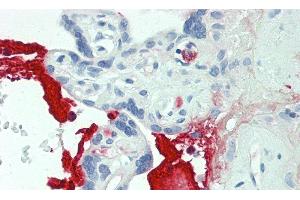 Detection of MMP12 in Human Placenta Tissue using Polyclonal Antibody to Matrix Metalloproteinase 12 (MMP12)