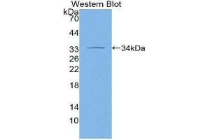 Western Blotting (WB) image for anti-Adenylate Cyclase 1 (Brain) (ADCY1) (AA 303-569) antibody (ABIN3206814) (ADCY1 anticorps  (AA 303-569))