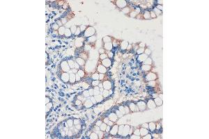 Immunohistochemistry of paraffin-embedded Human colon using CHDH Rabbit pAb (ABIN7266341) at dilution of 1:100 (40x lens).
