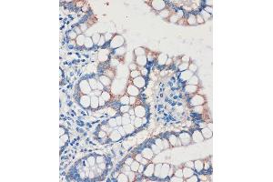 Immunohistochemistry of paraffin-embedded Human colon using CHDH Rabbit pAb (ABIN7266341) at dilution of 1:100 (40x lens). (CHDH anticorps  (AA 245-594))