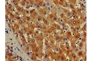 Immunohistochemistry of paraffin-embedded human liver tissue using ABIN7157050 at dilution of 1:100 (ISCA1 anticorps  (AA 67-122))