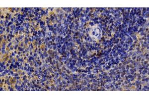Detection of JNK1 in Rat Spleen Tissue using Polyclonal Antibody to c-Jun N-terminal Kinase 1 (JNK1)