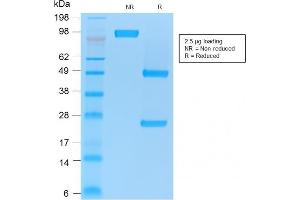 SDS-PAGE Analysis Purified CD86 Mouse Recombinant Monoclonal Antibody (rC86/1146). (Recombinant CD86 anticorps)