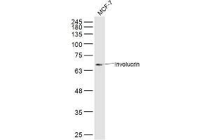 MCF7 lysates probed with Involucrin Polyclonal Antibody, Unconjugated  at 1:300 dilution and 4˚C overnight incubation. (Involucrin anticorps  (AA 21-120))