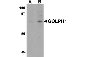 Western blot analysis of GOLPH1 in K562 cell lysate with GOLPH1 antibody at (A) 1 and (B) 2 µg/mL. (ACBD3 anticorps  (N-Term))