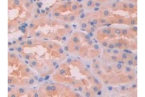 Detection of SAP in Human Kidney Tissue using Polyclonal Antibody to Serum Amyloid P Component (SAP)