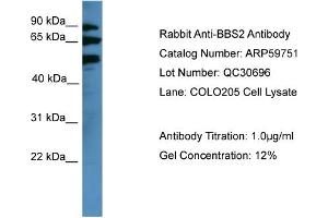 WB Suggested Anti-BBS2  Antibody Titration: 0. (BBS2 anticorps  (Middle Region))